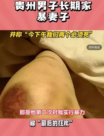 现场曝光