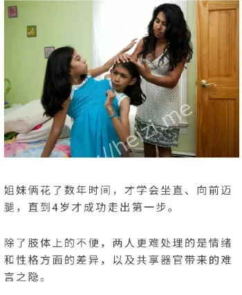 双胞胎