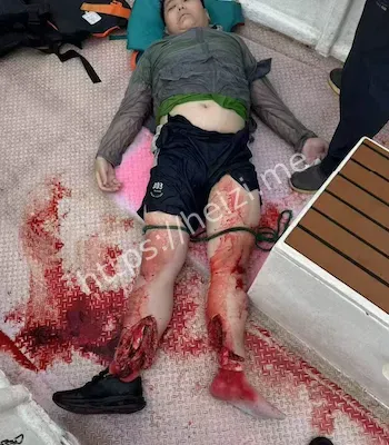 船舶起火