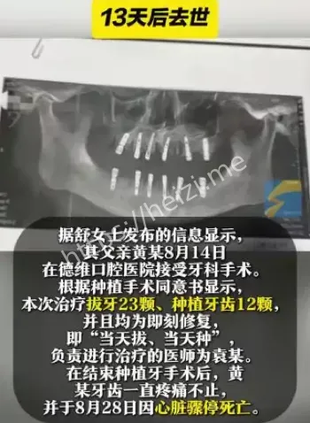 13天去世