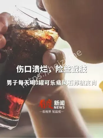 痛风石形成