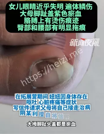 未成年人保护