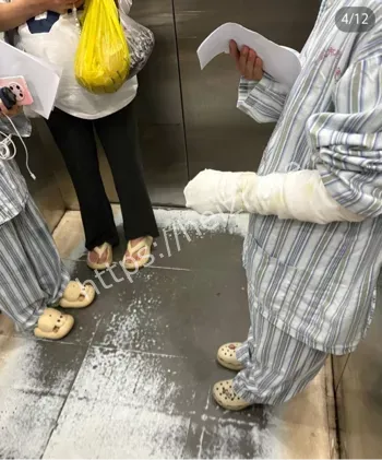 卡式炉爆炸