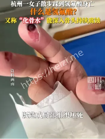 化骨水