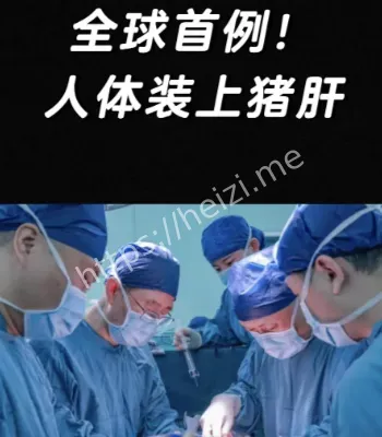 亲体肝移植