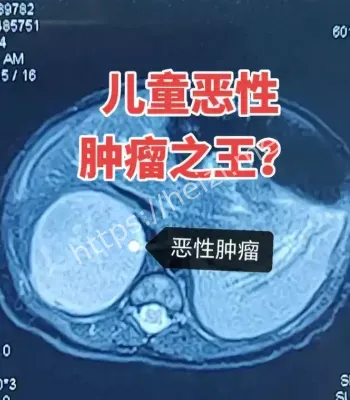 儿童癌症之王