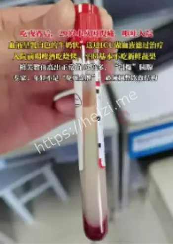 牛奶血