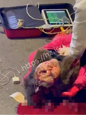 福州闽侯南屿车祸